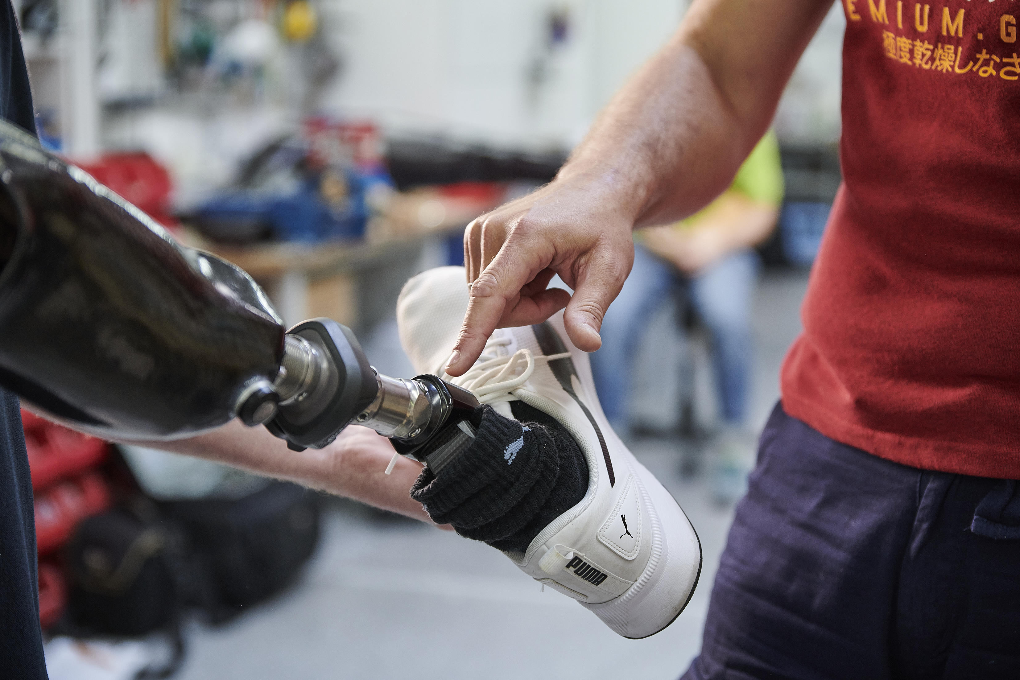 Eine Hand zeigt auf eine Beinprothese.